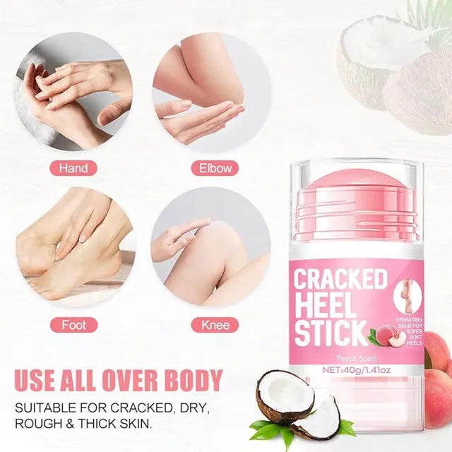 60% Urea Cream plus 2% Salicylic Acid - 1.41 oz Urea Foot Hand Cream Stick for Repairing Restore Balm